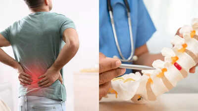Back pain vs slipped disc: How to tell the difference