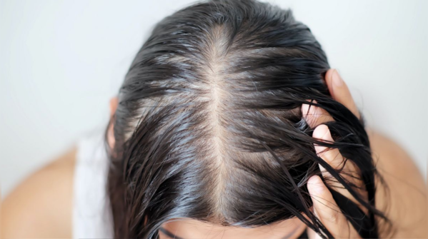 Keep your scalp clean